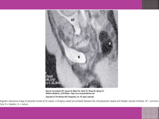 Mri in ob  gy practice