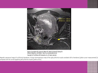 Mri in ob  gy practice