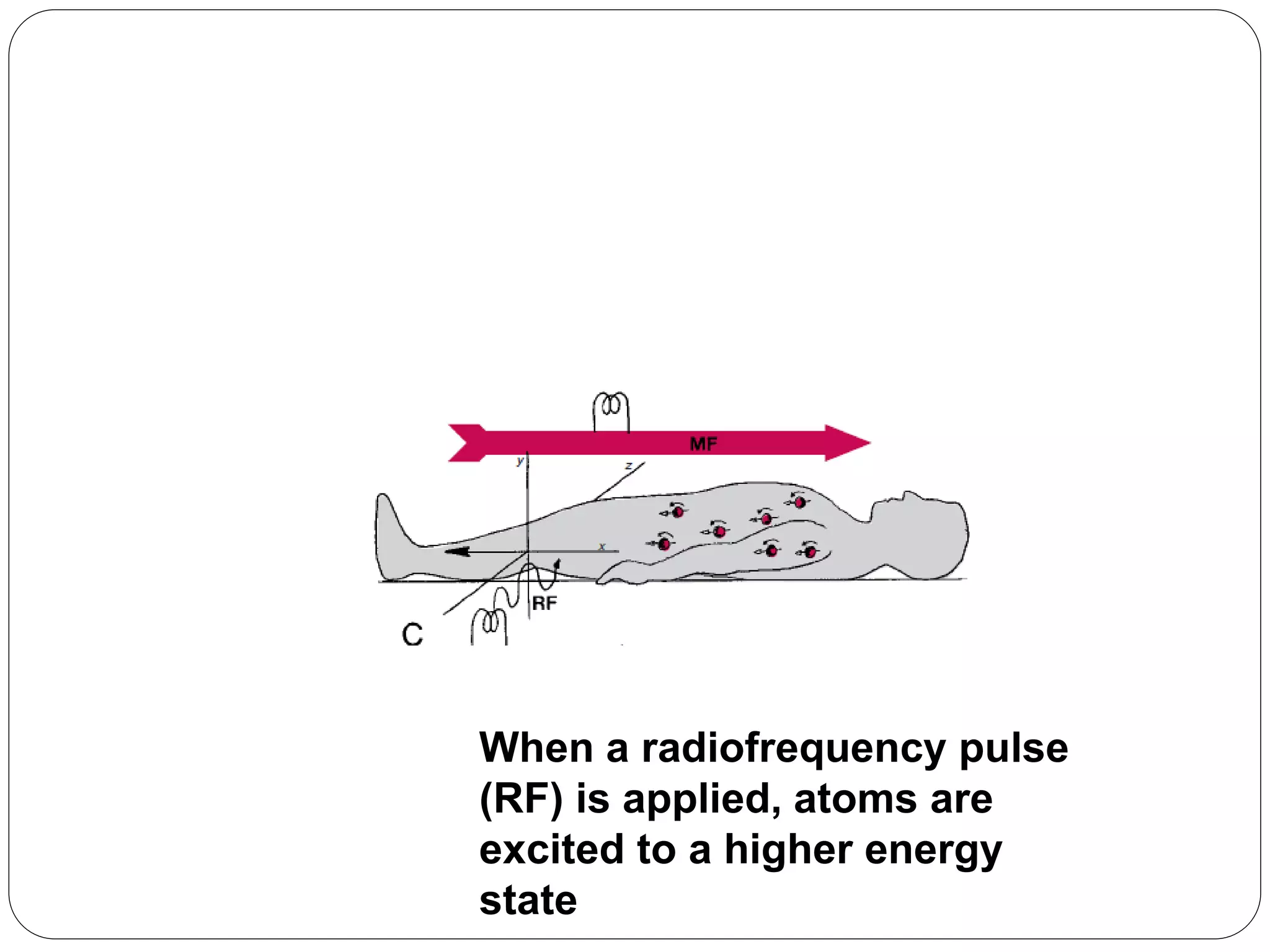 MRI in orthopaedics | PPTX