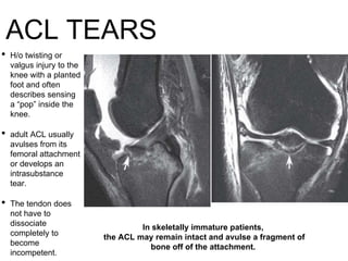 MRI in Orthopibohuvuvuvuvuvuvyvyvaedics.pptx