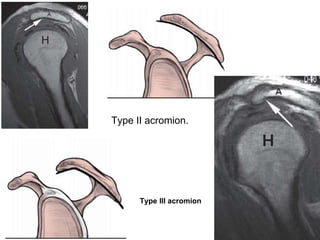 MRI in Orthopibohuvuvuvuvuvuvyvyvaedics.pptx