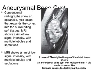 MRI in Orthopibohuvuvuvuvuvuvyvyvaedics.pptx
