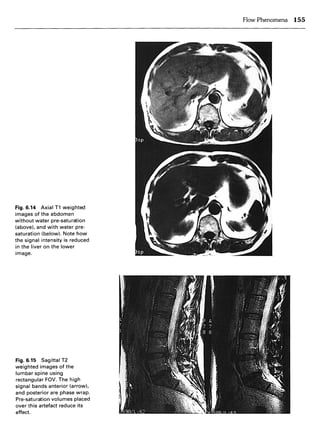 Mri in practice