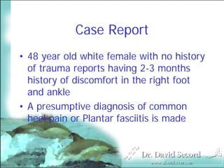 Mri In Stress Fractures