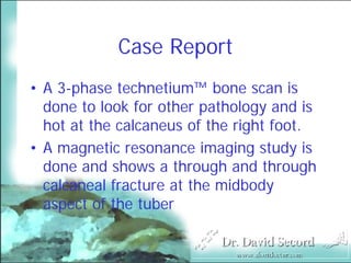Mri In Stress Fractures