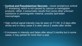 • Cortical and Pseudolaminar Necrosis - cause serpiginous cortical
T1 shortening, which is not caused by calcium or hemoglobin
products; rather, it presumably results from some other unknown
substance or paramagnetic material, possibly lipid-laden
macrophages.
• High cortical signal intensity may be seen on T1-WI, 3–5 days after
stroke and in many cases it is seen about 2 weeks after stroke.
• It increases in intensity and fades after about 3 months but in some
cases, it may persist for more than a year.
 