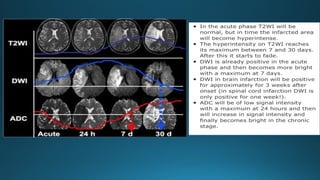 MRI IN  STROKE RADIOLOGY PRESENTATION...