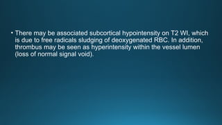 • There may be associated subcortical hypointensity on T2 WI, which
is due to free radicals sludging of deoxygenated RBC. In addition,
thrombus may be seen as hyperintensity within the vessel lumen
(loss of normal signal void).
 
