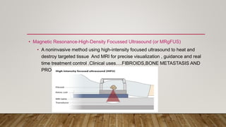 • Magnetic Resonance-High-Density Focussed Ultrasound (or MRgFUS)
• A noninvasive method using high-intensity focused ultrasound to heat and
destroy targeted tissue And MRI for precise visualization , guidance and real
time treatment control .Clinical uses….FIBROIDS,BONE METASTASIS AND
PROSTRATE ETC.
 