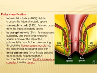 Mri in surgery | PPTX