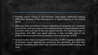▪ Prostate cancer arising in the transition zone poses additional imaging
difficulties because of the heterogeneity of signal intensity in the central
gland.
▪ Although there are several findings supporting the diagnosis of a transition
zone tumor , such as a region of homogeneous low T2 signal intensity in the
transition zone and lack of the low-signal-intensity rim commonly seen in
association with BPH, low signal intensity is also normally seen in the
anterior fibromuscular stroma as well as in the stromal type of BPH.
▪ Several studies that investigated the accuracy of MR imaging in detection
of prostate cancer reported low sensitivity, low specificity, and high inter
observer variability, even when high-resolution endorectal MR imaging was
used.
 