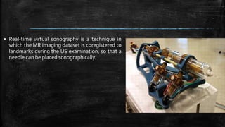▪ Real-time virtual sonography is a technique in
which the MR imaging dataset is coregistered to
landmarks during the US examination, so that a
needle can be placed sonographically.
 