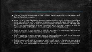 ▪ The MR imaging appearance of clear cell RCC varies depending on the presence of
hemorrhage and necrosis.
▪ Clear cell RCC most frequently demonstrates a signal intensity similar to that of the
renal parenchyma on T1-weighted images and increased signal intensity on T2-
weighted images. Loss of signal intensity within the solid portions of clear cell
RCCs on opposed-phase images compared with in-phase images is due to
cytoplasmic fat and has been observed in up to 60% of these tumors
▪ Central necrosis is common and is typically seen as a homogeneous hypointense
area in the center of the mass onT1-weighted images.
▪ On T2-weighted images, necrosis tends to have moderate to high signal intensity
(Fig 2), although occasionally it may appear hypointense.
▪ In the presence of central necrosis, a solid rim of tumor is frequently seen at the
periphery of the mass. Postcontrast images demonstrate lack of enhancement in
areas of necrosis and marked enhancement in the viable components of the tumor.
 