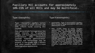 Papillary RCC accounts for approximately
10%–15% of all RCCs and may be multifocal.
Type I (basophilic)
Type I (basophilic) papillary tumors
are composed of small cuboidal cells
with uniform nuclei covering thin
papillae.
they demonstrate homogeneous low
signal intensity on T2-weighted
images, with homogeneous low-level
enhancement after intravenous
contrast material administration.
Necrosis and hemorrhage may be
present in low-grade type I tumors
and, when present, result in a more
heterogeneous appearance.
Type II (eosinophilic)
▪ eosinophilic. Type II (eosinophilic) papillary
RCCs consist of large eosinophilic cells with
pleomorphic nuclei.
▪ they usually have a more complex
appearance than do low-grade papillary
tumors, with hemorrhage and necrosis.
Enhancing papillary projections at the
periphery of a cystic hemorrhagic mass are
common and can be better depicted on
subtraction images. A fibrous capsule is
typically present in papillary RCCs. Type I
tumors tend to be of lower nuclear grade
than type II tumors. However, the histologic
subtype is an independent predictor of
prognosis regardless of the nuclear grade
(17)
 