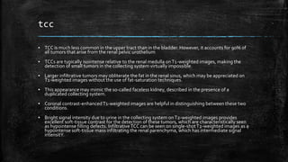 tcc
▪ TCC is much less common in the upper tract than in the bladder. However, it accounts for 90% of
all tumors that arise from the renal pelvic urothelium
▪ TCCs are typically isointense relative to the renal medulla onT1-weighted images, making the
detection of small tumors in the collecting system virtually impossible.
▪ Larger infiltrative tumors may obliterate the fat in the renal sinus, which may be appreciated on
T1-weighted images without the use of fat-saturation techniques.
▪ This appearance may mimic the so-called faceless kidney, described in the presence of a
duplicated collecting system.
▪ Coronal contrast-enhancedT1-weighted images are helpful in distinguishing between these two
conditions.
▪ Bright signal intensity due to urine in the collecting system onT2-weighted images provides
excellent soft-tissue contrast for the detection of these tumors, which are characteristically seen
as hypointense filling defects. InfiltrativeTCC can be seen on single-shotT2-weighted images as a
hypointense soft-tissue mass infiltrating the renal parenchyma, which has intermediate signal
intensitY.
 