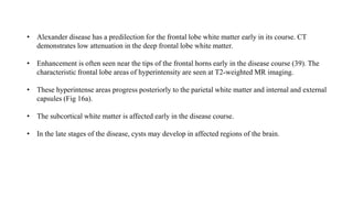 • Alexander disease has a predilection for the frontal lobe white matter early in its course. CT
demonstrates low attenuation in the deep frontal lobe white matter.
• Enhancement is often seen near the tips of the frontal horns early in the disease course (39). The
characteristic frontal lobe areas of hyperintensity are seen at T2-weighted MR imaging.
• These hyperintense areas progress posteriorly to the parietal white matter and internal and external
capsules (Fig 16a).
• The subcortical white matter is affected early in the disease course.
• In the late stages of the disease, cysts may develop in affected regions of the brain.
 