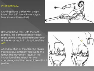 Mri knee trauma | PPTX