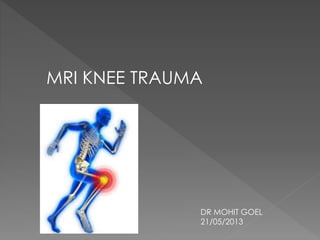 MRI KNEE TRAUMA
DR MOHIT GOEL
21/05/2013
 