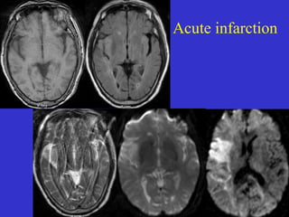 Mr imaging of brain | PPT