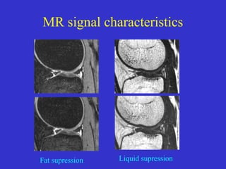 Fat Signal Mr imaging of brain | PPT