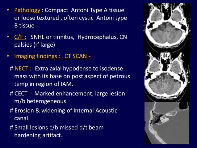 Magnetic Resonance Imaging Of Inner Ear