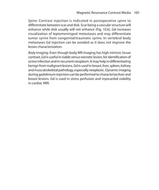 101 Magnetic Resonance Contrast Media
Spine: Contrast injection is indicated in postoperative spine to
differentiate between scar and disk. Scar being a vascular structure will
enhance while disk usually will not enhance (Fig. 10.6). Gd increases
visualization of leptomeningeal metastases and may differentiate
tumor syrinx from congenital/traumatic syrinx. In vertebral body
metastases Gd injection can be avoided as it does not improve the
lesion characterization.
Body Imaging: Even though body MR imaging has high intrinsic tissue
contrast, Gd is useful in viable versus necrotic lesion, for identification of
active infection and in recurrent neoplasm. It may help in differentiating
benign from malignant lesions. Gd is used in breast, liver, spleen, kidney
andmusculoskeletalpathology,especiallyneoplastic.Dynamicimaging
during gadolinium injection can be performed to characterize liver and
breast lesions. Gd is used in stress perfusion and myocardial viability
in cardiac MRI.
Ch-10.indd 101 13-09-2012 16:05:49
 