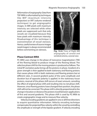 133 Magnetic Resonance Angiography
Fig. 14.4: Time of flight MR
angiography of carotid and
vertebral arteries, coronal view
Reformationofangiography:Datafrom
TOF MRA is reformatted by techniques
like MIP (maximum intensity
projection) or VRT (volume rendered
technique) to get angiographic
images. In MIP, pixels with maximum
intensity are selected while other
pixels are suppressed such that only
vessels are visualized because they
have pixels with maximum intensity.
Disadvantage of this technique is
overestimation of vessel stenosis.
Hence,carefulreviewofsourceimages
(axial images) is always recommended
before commenting on stenosis.
Phase Contrast MRA
PC-MRA uses change in the phase of transverse magnetization (TM)
of the flowing blood to produce image of the flowing blood. The
selective phase shift for the moving protons is produced as follows.The
initial RF excitation pulse brings all the protons in phase. Gradient of a
given strength is then applied to both stationary and flowing protons
that causes phase shift in both stationary and flowing protons but at
different rates. A second gradient pulse of the same amplitude and
duration but of opposite polarity is applied. In the stationary tissue
protons, reversal of the phase shift occurs of exact amount, canceling
the effect of original phase shift and resulting into no net phase shift.
However, since flowing protons have changed their position, the phase
shift will not be corrected.This phase shift is directly proportional to the
change in location or distance the protons travel between applications
of first and second gradients. This phase shift is used by PC-MRA to
create angiographic image and to measure flow velocity.
	 Velocityencodinggradientsareappliedinoneorallthreedirections
to acquire quantitative information. Velocity encoding technique
compensates for projected flow velocity within the vessel by controlling
the amplitude or strength of the bipolar gradient. If velocity encoding
Ch-14.indd 133 13-09-2012 16:13:45
 
