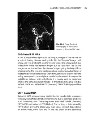 135 Magnetic Resonance Angiography
ECG-Gated FSE MRA
In this ECG-gated fast spin-echo technique, images of the vessels are
acquired during diastole and systole. On the ‘diastole’ image both
artery and vein are bright. On the‘systole’image the artery is dark due
to fast flow while vein remains bright due to slow flow. The ‘systole’
images are subtracted from the‘diastole’images giving the bright blood
arteriography.The vein and background are subtracted. Advantages of
this technique include relatively short-time, sensitivity to slow flow and
ability to acquire in coronal plane parallel to the vessels. It may not be
suitable for patients with arrhythmia. It is mainly used for peripheral
arteries and aorta. Examples include FBI (fresh blood imaging,Toshiba),
NATIVE SPACE and NATIVE HASTE (Siemens),TRANCE (Philips) and Flow
prep.
SSFP-Based MRA
Balanced SSFP sequences are gradient echo steady-state sequences
with very high SNR and motion insensitivity due to balanced gradients
in all three directions. These sequences are called TruFISP (Siemens),
FIESTA (GE) and balanced-TFE (Philips). The contrast is determined by
T2/T1 ration giving the blood very high signal without dependence
on inflow. Veins, other fluid and fat are also bright on this sequence.
Fig. 14.5: Phase Contrast
Venography of intracranial
venous system, sagittal view
Ch-14.indd 135 13-09-2012 16:13:45
 