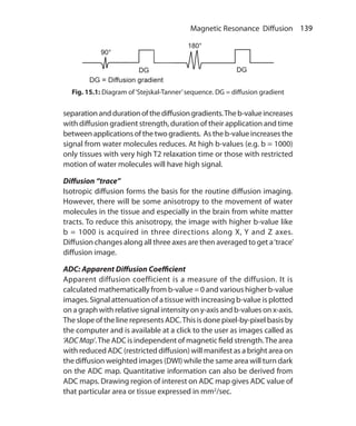 139 Magnetic Resonance Diffusion
separationanddurationofthediffusiongradients.Theb-valueincreases
with diffusion gradient strength, duration of their application and time
between applications of the two gradients. As the b-value increases the
signal from water molecules reduces. At high b-values (e.g. b = 1000)
only tissues with very high T2 relaxation time or those with restricted
motion of water molecules will have high signal.
Diffusion “trace”
Isotropic diffusion forms the basis for the routine diffusion imaging.
However, there will be some anisotropy to the movement of water
molecules in the tissue and especially in the brain from white matter
tracts. To reduce this anisotropy, the image with higher b-value like
b = 1000 is acquired in three directions along X, Y and Z axes.
Diffusion changes along all three axes are then averaged to get a‘trace’
diffusion image.
ADC: Apparent Diffusion Coefficient
Apparent diffusion coefficient is a measure of the diffusion. It is
calculated mathematically from b-value = 0 and various higher b-value
images. Signal attenuation of a tissue with increasing b-value is plotted
on a graph with relative signal intensity on y-axis and b-values on x-axis.
The slope of the line represents ADC.This is done pixel-by-pixel basis by
the computer and is available at a click to the user as images called as
‘ADCMap’.The ADC is independent of magnetic field strength.The area
with reduced ADC (restricted diffusion) will manifest as a bright area on
the diffusion weighted images (DWI) while the same area will turn dark
on the ADC map. Quantitative information can also be derived from
ADC maps. Drawing region of interest on ADC map gives ADC value of
that particular area or tissue expressed in mm2
/sec.
Fig. 15.1: Diagram of‘Stejskal-Tanner’sequence. DG = diffusion gradient
Ch-15.indd 139 13-09-2012 16:15:02
 