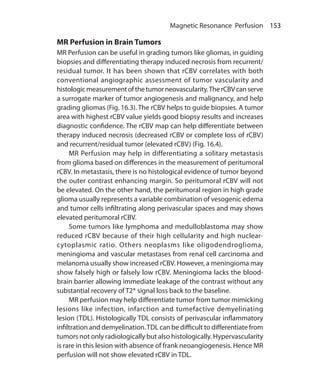 153 Magnetic Resonance Perfusion
MR Perfusion in Brain Tumors
MR Perfusion can be useful in grading tumors like gliomas, in guiding
biopsies and differentiating therapy induced necrosis from recurrent/
residual tumor. It has been shown that rCBV correlates with both
conventional angiographic assessment of tumor vascularity and
histologicmeasurementofthetumorneovascularity.TherCBVcanserve
a surrogate marker of tumor angiogenesis and malignancy, and help
grading gliomas (Fig. 16.3). The rCBV helps to guide biopsies. A tumor
area with highest rCBV value yields good biopsy results and increases
diagnostic confidence. The rCBV map can help differentiate between
therapy induced necrosis (decreased rCBV or complete loss of rCBV)
and recurrent/residual tumor (elevated rCBV) (Fig. 16.4).
	 MR Perfusion may help in differentiating a solitary metastasis
from glioma based on differences in the measurement of peritumoral
rCBV. In metastasis, there is no histological evidence of tumor beyond
the outer contrast enhancing margin. So peritumoral rCBV will not
be elevated. On the other hand, the peritumoral region in high grade
glioma usually represents a variable combination of vesogenic edema
and tumor cells infiltrating along perivascular spaces and may shows
elevated peritumoral rCBV.
	 Some tumors like lymphoma and medulloblastoma may show
reduced rCBV because of their high cellularity and high nuclear-
cytoplasmic ratio. Others neoplasms like oligodendroglioma,
meningioma and vascular metastases from renal cell carcinoma and
melanoma usually show increased rCBV. However, a meningioma may
show falsely high or falsely low rCBV. Meningioma lacks the blood-
brain barrier allowing immediate leakage of the contrast without any
substantial recovery of T2* signal loss back to the baseline.
	 MR perfusion may help differentiate tumor from tumor mimicking
lesions like infection, infarction and tumefactive demyelinating
lesion (TDL). Histologically TDL consists of perivascular inflammatory
infiltration and demyelination.TDL can be difficult to differentiate from
tumors not only radiologically but also histologically. Hypervascularity
is rare in this lesion with absence of frank neoangiogenesis. Hence MR
perfusion will not show elevated rCBV in TDL.
Ch-16.indd 153 13-09-2012 16:15:56
 