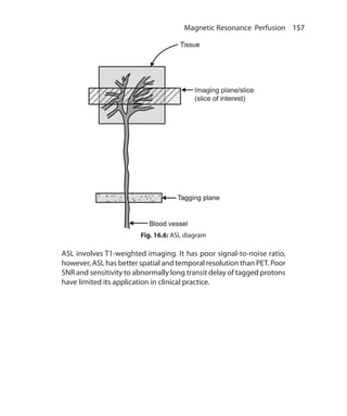 157 Magnetic Resonance Perfusion
Fig. 16.6: ASL diagram
ASL involves T1-weighted imaging. It has poor signal-to-noise ratio,
however, ASL has better spatial and temporal resolution than PET. Poor
SNR and sensitivity to abnormally long transit delay of tagged protons
have limited its application in clinical practice.
Ch-16.indd 157 13-09-2012 16:15:56
 