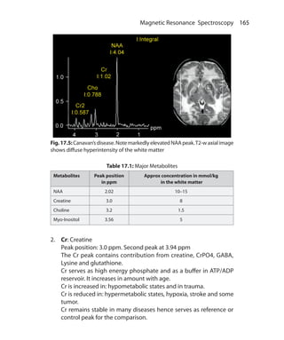 165 Magnetic Resonance Spectroscopy
Table 17.1: Major Metabolites
Metabolites Peak position
in ppm
Approx concentration in mmol/kg
in the white matter
NAA 2.02 10–15
Creatine 3.0 8
Choline 3.2 1.5
Myo-Inositol 3.56 5
2.	 Cr: Creatine
	 Peak position: 3.0 ppm. Second peak at 3.94 ppm
	 The Cr peak contains contribution from creatine, CrPO4, GABA,
Lysine and glutathione.
	 Cr serves as high energy phosphate and as a buffer in ATP/ADP
reservoir. It increases in amount with age.
	 Cr is increased in: hypometabolic states and in trauma.
	 Cr is reduced in: hypermetabolic states, hypoxia, stroke and some
tumor.
	 Cr remains stable in many diseases hence serves as reference or
control peak for the comparison.
Fig.17.5:Canavan’sdisease.NotemarkedlyelevatedNAApeak.T2-waxialimage
shows diffuse hyperintensity of the white matter
Ch-17.indd 165 13-09-2012 16:17:23
 