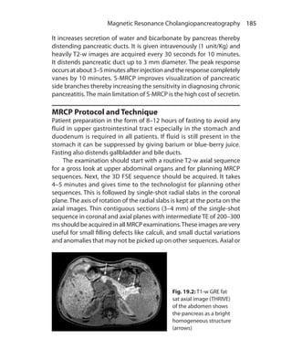 185 Magnetic Resonance Cholangiopancreatography
It increases secretion of water and bicarbonate by pancreas thereby
distending pancreatic ducts. It is given intravenously (1 unit/Kg) and
heavily T2-w images are acquired every 30 seconds for 10 minutes.
It distends pancreatic duct up to 3 mm diameter. The peak response
occursatabout3–5minutesafterinjectionandtheresponsecompletely
vanes by 10 minutes. S-MRCP improves visualization of pancreatic
side branches thereby increasing the sensitivity in diagnosing chronic
pancreatitis.The main limitation of S-MRCP is the high cost of secretin.
MRCP Protocol and Technique
Patient preparation in the form of 8–12 hours of fasting to avoid any
fluid in upper gastrointestinal tract especially in the stomach and
duodenum is required in all patients. If fluid is still present in the
stomach it can be suppressed by giving barium or blue-berry juice.
Fasting also distends gallbladder and bile ducts.
	 The examination should start with a routine T2-w axial sequence
for a gross look at upper abdominal organs and for planning MRCP
sequences. Next, the 3D FSE sequence should be acquired. It takes
4–5 minutes and gives time to the technologist for planning other
sequences. This is followed by single-shot radial slabs in the coronal
plane. The axis of rotation of the radial slabs is kept at the porta on the
axial images. Thin contiguous sections (3–4 mm) of the single-shot
sequence in coronal and axial planes with intermediate TE of 200–300
ms should be acquired in all MRCP examinations.These images are very
useful for small filling defects like calculi, and small ductal variations
and anomalies that may not be picked up on other sequences. Axial or
Fig. 19.2: T1-w GRE fat
sat axial image (THRIVE)
of the abdomen shows
the pancreas as a bright
homogeneous structure
(arrows)
Ch-19.indd 185 13-09-2012 16:19:26
 