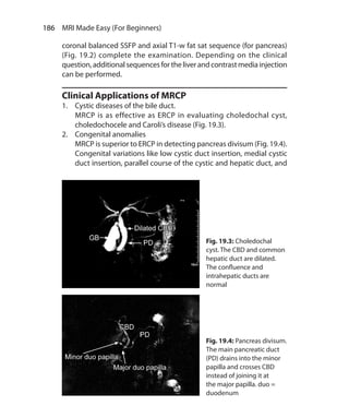 186  MRI Made Easy (For Beginners)
coronal balanced SSFP and axial T1-w fat sat sequence (for pancreas)
(Fig. 19.2) complete the examination. Depending on the clinical
question,additionalsequencesfortheliverandcontrastmediainjection
can be performed.
Clinical Applications of MRCP
1.	 Cystic diseases of the bile duct.
	 MRCP is as effective as ERCP in evaluating choledochal cyst,
choledochocele and Caroli’s disease (Fig. 19.3).
2.	 Congenital anomalies
	 MRCP is superior to ERCP in detecting pancreas divisum (Fig. 19.4).
Congenital variations like low cystic duct insertion, medial cystic
duct insertion, parallel course of the cystic and hepatic duct, and
Fig. 19.3: Choledochal
cyst. The CBD and common
hepatic duct are dilated.
The confluence and
intrahepatic ducts are
normal
Fig. 19.4: Pancreas divisum.
The main pancreatic duct
(PD) drains into the minor
papilla and crosses CBD
instead of joining it at
the major papilla. duo =
duodenum
Ch-19.indd 186 13-09-2012 16:19:26
 