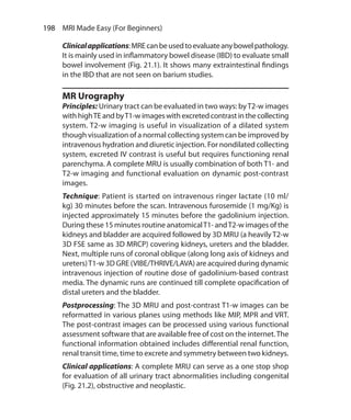 198  MRI Made Easy (For Beginners)
Clinicalapplications:MREcanbeusedtoevaluateanybowelpathology.
It is mainly used in inflammatory bowel disease (IBD) to evaluate small
bowel involvement (Fig. 21.1). It shows many extraintestinal findings
in the IBD that are not seen on barium studies.
MR Urography
Principles: Urinary tract can be evaluated in two ways: byT2-w images
withhighTEandbyT1-wimageswithexcretedcontrastinthecollecting
system. T2-w imaging is useful in visualization of a dilated system
though visualization of a normal collecting system can be improved by
intravenous hydration and diuretic injection. For nondilated collecting
system, excreted IV contrast is useful but requires functioning renal
parenchyma. A complete MRU is usually combination of both T1- and
T2-w imaging and functional evaluation on dynamic post-contrast
images.
Technique: Patient is started on intravenous ringer lactate (10 ml/
kg) 30 minutes before the scan. Intravenous furosemide (1 mg/Kg) is
injected approximately 15 minutes before the gadolinium injection.
During these 15 minutes routine anatomicalT1- andT2-w images of the
kidneys and bladder are acquired followed by 3D MRU (a heavily T2-w
3D FSE same as 3D MRCP) covering kidneys, ureters and the bladder.
Next, multiple runs of coronal oblique (along long axis of kidneys and
ureters)T1-w 3D GRE (VIBE/THRIVE/LAVA) are acquired during dynamic
intravenous injection of routine dose of gadolinium-based contrast
media. The dynamic runs are continued till complete opacification of
distal ureters and the bladder.
Postprocessing: The 3D MRU and post-contrast T1-w images can be
reformatted in various planes using methods like MIP, MPR and VRT.
The post-contrast images can be processed using various functional
assessment software that are available free of cost on the internet.The
functional information obtained includes differential renal function,
renal transit time, time to excrete and symmetry between two kidneys.
Clinical applications: A complete MRU can serve as a one stop shop
for evaluation of all urinary tract abnormalities including congenital
(Fig. 21.2), obstructive and neoplastic.
Ch-21.indd 198 13-09-2012 16:21:02
 