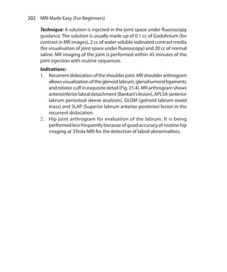 202  MRI Made Easy (For Beginners)
Technique: A solution is injected in the joint space under fluoroscopy
guidance. The solution is usually made up of 0.1 cc of Gadolinium (for
contrast in MR images), 2 cc of water soluble iodinated contrast media
(for visualisation of joint space under fluoroscopy) and 20 cc of normal
saline. MR imaging of the joint is performed within 45 minutes of the
joint injection with routine sequences.
Indications:
1.	 Recurrentdislocationoftheshoulderjoint.MRshoulderarthrogram
allows visualization of the glenoid labrum, glenohumeral ligaments
and rotator cuff in exquisite detail (Fig. 21.4). MR arthrogram shows
anteroinferior labral detachment (Bankart’s lesion), APLSA (anterior
labrum periosteal sleeve avulsion), GLOM (gelnoid labrum ovoid
mass) and SLAP (Superior labrum anterior-posterior) lesion in the
recurrent dislocation.
2.	 Hip joint arthrogram for evaluation of the labrum. It is being
performed less frequently because of good accuracy of routine hip
imaging at 3Tesla MRI for the detection of labral abnormalities.
Ch-21.indd 202 13-09-2012 16:21:03
 
