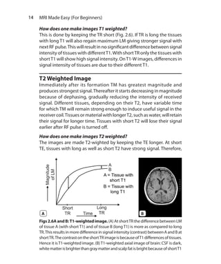 14  MRI Made Easy (For Beginners)
How does one make images T1 weighted?
This is done by keeping the TR short (Fig. 2.6). If TR is long the tissues
with long T1 will also regain maximum LM giving stronger signal with
next RF pulse.This will result in no significant difference between signal
intensity of tissues with differentT1.With shortTR only the tissues with
shortT1 will show high signal intensity. OnT1-W images, differences in
signal intensity of tissues are due to their different T1.
T2 Weighted Image
Immediately after its formation TM has greatest magnitude and
produces strongest signal.Thereafter it starts decreasing in magnitude
because of dephasing, gradually reducing the intensity of received
signal. Different tissues, depending on their T2, have variable time
for which TM will remain strong enough to induce useful signal in the
receiver coil.Tissues or material with longerT2, such as water, will retain
their signal for longer time. Tissues with short T2 will lose their signal
earlier after RF pulse is turned off.
How does one make images T2 weighted?
The images are made T2-wighted by keeping the TE longer. At short
TE, tissues with long as well as short T2 have strong signal. Therefore,
Figs2.6AandB: T1-weightedimage. (A) At shortTR the difference between LM
of tissue A (with short T1) and of tissue B (long T1) is more as compared to long
TR.Thisresultsinmoredifferencein signalintensity(contrast)betweenAandBat
shortTR.ThecontrastontheshortTRimageisbecauseofT1differencesoftissues.
Hence it isT1-weighted image. (B)T1-weighted axial image of brain: CSF is dark,
whitematterisbrighterthangraymatterandscalpfatisbrightbecauseofshortT1
BA
Ch-2.indd 14 13-09-2012 15:52:34
 