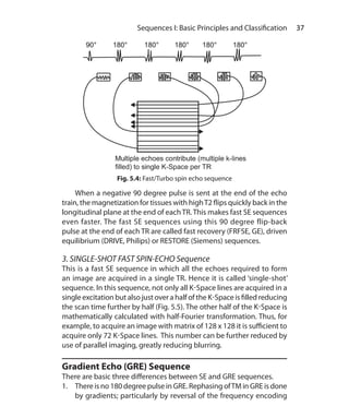 37 Sequences I: Basic Principles and Classification
	 When a negative 90 degree pulse is sent at the end of the echo
train, the magnetization for tissues with highT2 flips quickly back in the
longitudinal plane at the end of each TR. This makes fast SE sequences
even faster. The fast SE sequences using this 90 degree flip-back
pulse at the end of each TR are called fast recovery (FRFSE, GE), driven
equilibrium (DRIVE, Philips) or RESTORE (Siemens) sequences.
3. SINGLE-SHOT FAST SPIN-ECHO Sequence
This is a fast SE sequence in which all the echoes required to form
an image are acquired in a single TR. Hence it is called ‘single-shot’
sequence. In this sequence, not only all K-Space lines are acquired in a
single excitation but also just over a half of the K-Space is filled reducing
the scan time further by half (Fig. 5.5). The other half of the K-Space is
mathematically calculated with half-Fourier transformation. Thus, for
example, to acquire an image with matrix of 128 x 128 it is sufficient to
acquire only 72 K-Space lines. This number can be further reduced by
use of parallel imaging, greatly reducing blurring.
Gradient Echo (GRE) Sequence
There are basic three differences between SE and GRE sequences.
1.	 There is no 180 degree pulse in GRE. Rephasing ofTM in GRE is done
by gradients; particularly by reversal of the frequency encoding
Fig. 5.4: Fast/Turbo spin echo sequence
Ch-5.indd 37 13-09-2012 15:58:19
 