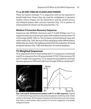 61 Sequences III: When to Use What Sequences
Figs 7.5A and B: Enhancement pattern with T1-w GRE sequence. Sagittal
T1-w 3D FLASH image (A) Shows two enhancing lesions (with tiny circle in their
center) in the breast. (B)The graph of degree of enhancement over time shows
that there is rapid uptake-rapid washout of contrast suggestive of probably
malignant lesions
T1-w 3D GRE (VIBE/3D-FLASH/LAVA/THRIVE)
These are fastest amongst T1-w sequences and can be acquired in
breath-hold time. Hence they are used for multiphasic or dynamic
studies where images can be obtained in arterial, portal venous
and delayed phases after contrast injection (Fig. 7.4) or pattern of
enhancement of a lesion can be assessed (Fig. 7.5).
Medium Ti Inversion Recovery Sequence
Sequences like MPRAGE (Siemens) and T1-FLAIR (Philips) are T1-w
sequences that use inversion pre-pulse with medium inversion time (TI)
in the range of 600-1200 ms.This increases contrast between gray and
whitematter(Fig.7.6A).Becauseoftheirgoodgray-whitedifferentiation
ability they are used in the epilepsy protocol for the evaluation of mesial
temporal sclerosis (Fig. 7.6B) and detection of cortical dysplasia.
T2-Weighted Sequences
T2-w sequences come in more variety thanT1-w sequences. Commonly
usedT2-w sequences from SE group includeT2 FSE,T2 fast recovery FSE
and T2 single shot sequences. T2-w sequences provided by inversion
recovery group are STIR and FLAIR. Even though STIR has combinedT1
A B
Ch-7.indd 61 13-09-2012 16:00:32
 