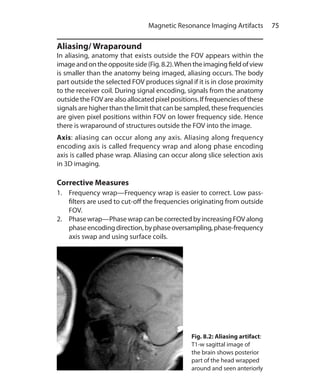 75 Magnetic Resonance Imaging Artifacts
Aliasing/ Wraparound
In aliasing, anatomy that exists outside the FOV appears within the
imageandontheoppositeside(Fig.8.2).Whentheimagingfieldofview
is smaller than the anatomy being imaged, aliasing occurs. The body
part outside the selected FOV produces signal if it is in close proximity
to the receiver coil. During signal encoding, signals from the anatomy
outside the FOV are also allocated pixel positions. If frequencies of these
signals are higher than the limit that can be sampled, these frequencies
are given pixel positions within FOV on lower frequency side. Hence
there is wraparound of structures outside the FOV into the image.
Axis: aliasing can occur along any axis. Aliasing along frequency
encoding axis is called frequency wrap and along phase encoding
axis is called phase wrap. Aliasing can occur along slice selection axis
in 3D imaging.
Corrective Measures
1.	 Frequency wrap—Frequency wrap is easier to correct. Low pass-
filters are used to cut-off the frequencies originating from outside
FOV.
2.	 Phase wrap—Phase wrap can be corrected by increasing FOV along
phaseencodingdirection,byphaseoversampling,phase-frequency
axis swap and using surface coils.
Fig. 8.2: Aliasing artifact:
T1-w sagittal image of
the brain shows posterior
part of the head wrapped
around and seen anteriorly
Ch-8.indd 75 13-09-2012 16:02:21
 