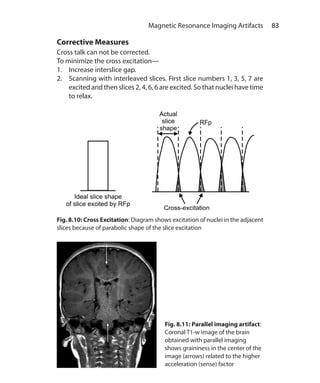 83 Magnetic Resonance Imaging Artifacts
Corrective Measures
Cross talk can not be corrected.
To minimize the cross excitation—
1.	 Increase interslice gap.
2.	 Scanning with interleaved slices. First slice numbers 1, 3, 5, 7 are
excited and then slices 2, 4, 6, 6 are excited. So that nuclei have time
to relax.
Fig. 8.10: Cross Excitation: Diagram shows excitation of nuclei in the adjacent
slices because of parabolic shape of the slice excitation
Fig. 8.11: Parallel imaging artifact:
Coronal T1-w image of the brain
obtained with parallel imaging
shows graininess in the center of the
image (arrows) related to the higher
acceleration (sense) factor
Ch-8.indd 83 13-09-2012 16:02:22
 