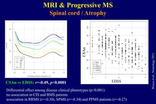C
MRI & Progressive MS
Spinal cord / Atrophy
CSAn vs EDSS: r=-0.49, p<0.0001 EDSS
CSAn
Differential effect among disease clinical phenotypes (p<0.001):
no association in CIS and BMS patients
association in RRMS (r=-0.30), SPMS (r=-0.34) and PPMS patients (r=-0.27)
Roccaetal.,Neurology2011
 