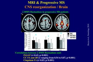 Correlations between  DMN fluctuations and:
PASAT (r=0.42, p<0.001)
CC FA and JD (r ranging from 0.54 to 0.87, p<0.001)
Cingulum FA (r=0.83, p<0.001)
Roccaetal.,Neurology2010
 DMN fluctuations in progressive MS patients
HC
PPMS
SPMS
MRI & Progressive MS
CNS reorganization / Brain
 