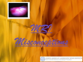 MRI
Misconceptions
 