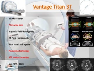 Modelity MRI MODELITY.pptx magnetic resonance imaging | PPTX