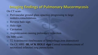 Mri Opacity Mri Mucormycosis imaging | PPTX