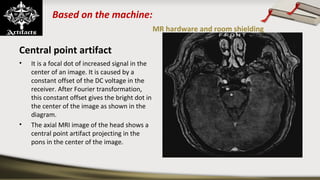 Based on the machine:
MR hardware and room shielding
Central point artifact
• It is a focal dot of increased signal in the
center of an image. It is caused by a
constant offset of the DC voltage in the
receiver. After Fourier transformation,
this constant offset gives the bright dot in
the center of the image as shown in the
diagram.
• The axial MRI image of the head shows a
central point artifact projecting in the
pons in the center of the image.
Correction and prevention
• Repeating the sequence may get rid of the
artifact.
• Maintain constant temperature in scanner
and equipment room for receiver
amplifiers.
• Software to estimate DC offset and adjust
the data in k-space.
• Call service engineer for recalibration.
 