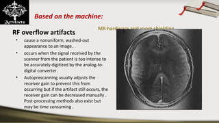 Based on the machine:
MR hardware and room shielding
RF overflow artifacts
• cause a nonuniform, washed-out
appearance to an image.
• occurs when the signal received by the
scanner from the patient is too intense to
be accurately digitized by the analog-to-
digital converter.
• Autoprescanning usually adjusts the
receiver gain to prevent this from
occurring but if the artifact still occurs, the
receiver gain can be decreased manually .
Post-processing methods also exist but
may be time consuming .
 