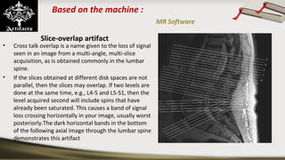 Based on the machine :
MR Software
Slice-overlap artifact
• Cross talk overlap is a name given to the loss of signal
seen in an image from a multi-angle, multi-slice
acquisition, as is obtained commonly in the lumbar
spine.
• If the slices obtained at different disk spaces are not
parallel, then the slices may overlap. If two levels are
done at the same time, e.g., L4-5 and L5-S1, then the
level acquired second will include spins that have
already been saturated. This causes a band of signal
loss crossing horizontally in your image, usually worst
posteriorly.The dark horizontal bands in the bottom
of the following axial image through the lumbar spine
demonstrates this artifact
 