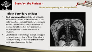 Based on the Patient :
Tissue heterogeneity and foreign bodies
Black boundary artifact
• Black boundary artifact or India ink artifact is 
an artificially created black line located at fat-
water interfaces such as those between muscle 
and fat. This results in a sharp delineation of 
the muscle-fat boundary that is sometimes 
visually appealing but not an anatomical 
structure. 
• Case here is a coronal image through the upper 
body with an echo time of 7 ms. A black line is 
seen surrounding the muscles of the shoulder 
girdle as well as around the liver.
 